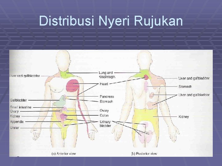 Distribusi Nyeri Rujukan 