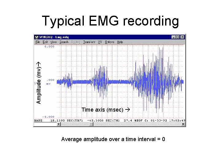 Amplitude (mv) Typical EMG recording Time axis (msec) Average amplitude over a time interval
