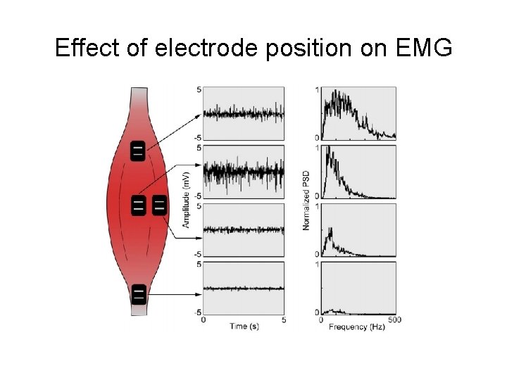 Effect of electrode position on EMG 