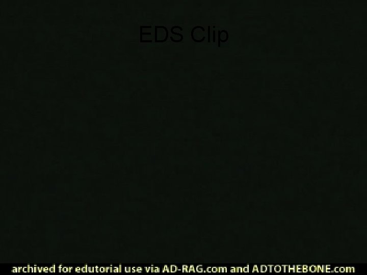 EDS Clip 