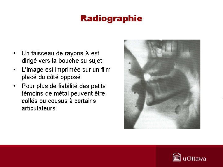 Radiographie • Un faisceau de rayons X est dirigé vers la bouche su sujet