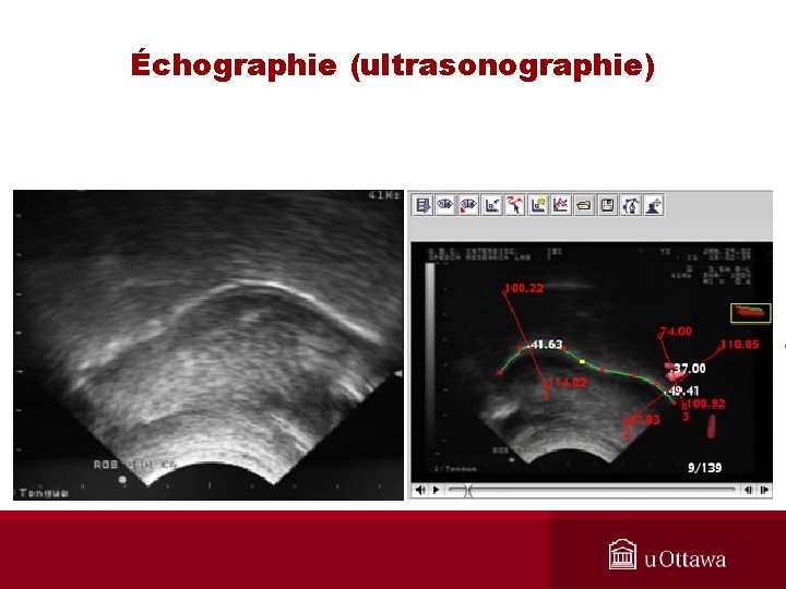 Échographie (ultrasonographie) 