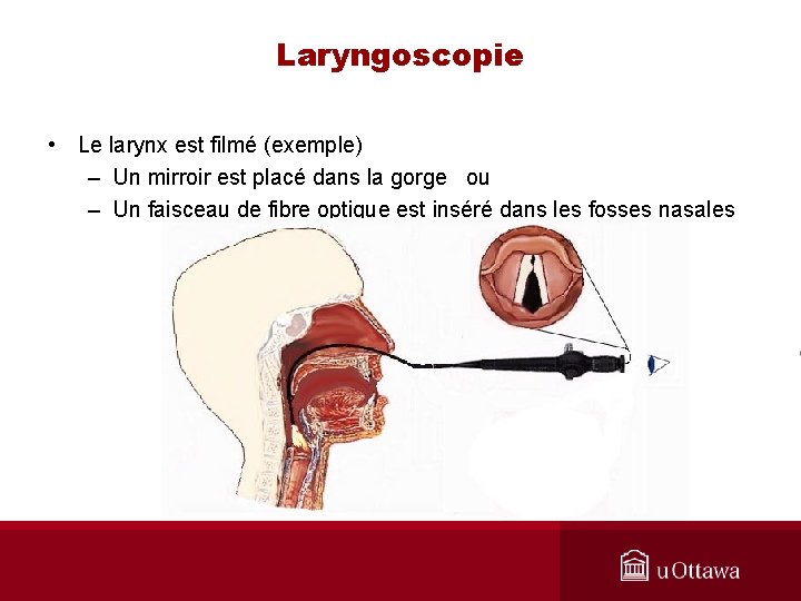 Laryngoscopie • Le larynx est filmé (exemple) – Un mirroir est placé dans la