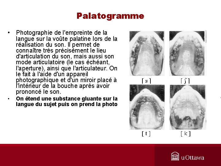 Palatogramme • Photographie de l'empreinte de la langue sur la voûte palatine lors de