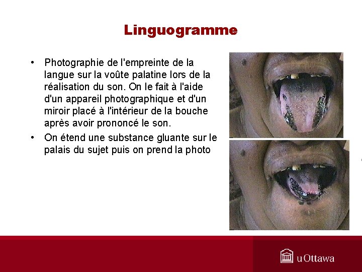 Linguogramme • Photographie de l'empreinte de la langue sur la voûte palatine lors de