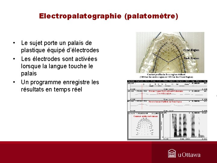 Electropalatographie (palatomètre) • Le sujet porte un palais de plastique équipé d’électrodes • Les