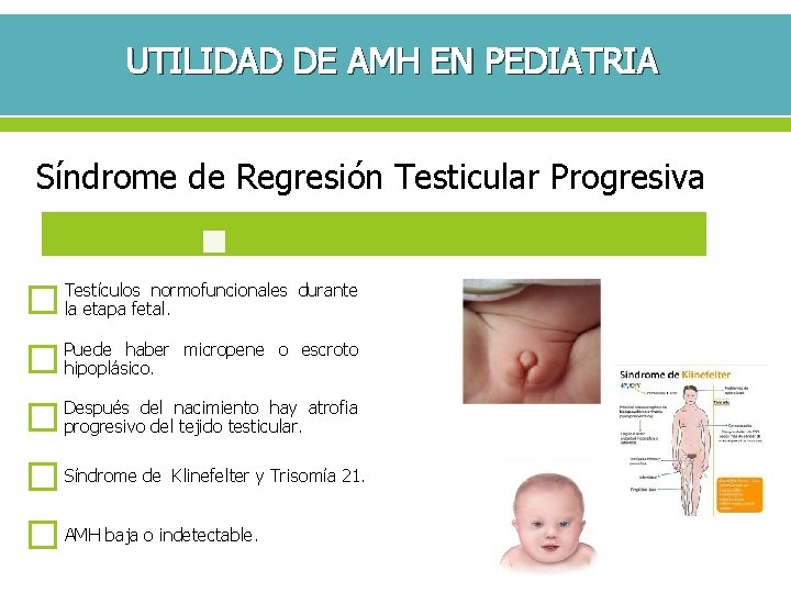 UTILIDAD DE AMH EN PEDIATRIA Síndrome de Regresión Testicular Progresiva Testículos normofuncionales durante la