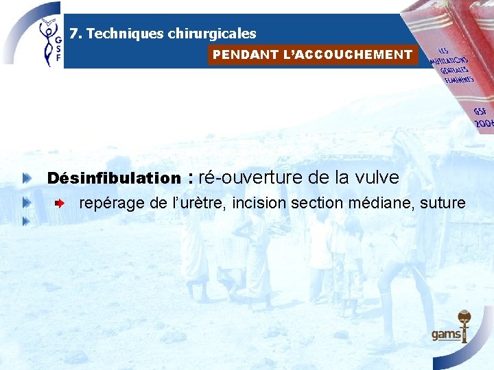 7. Techniques chirurgicales PENDANT L’ACCOUCHEMENT Désinfibulation : ré-ouverture de la vulve repérage de l’urètre,