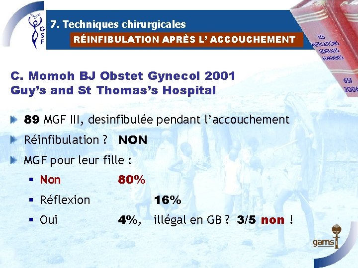 7. Techniques chirurgicales RÉINFIBULATION APRÈS L’ ACCOUCHEMENT C. Momoh BJ Obstet Gynecol 2001 Guy’s