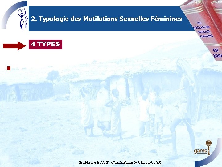 2. Typologie des Mutilations Sexuelles Féminines 4 TYPES n Classification de l'OMS (Classification du