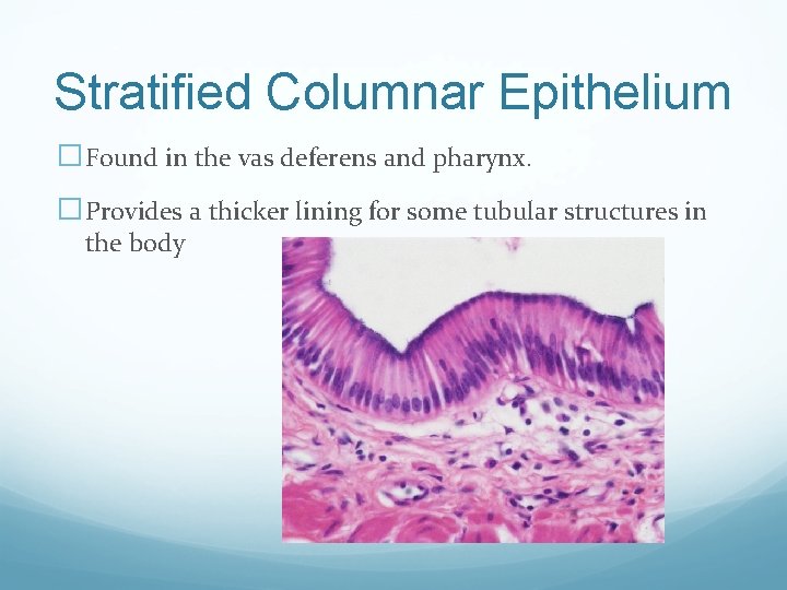 Stratified Columnar Epithelium �Found in the vas deferens and pharynx. �Provides a thicker lining