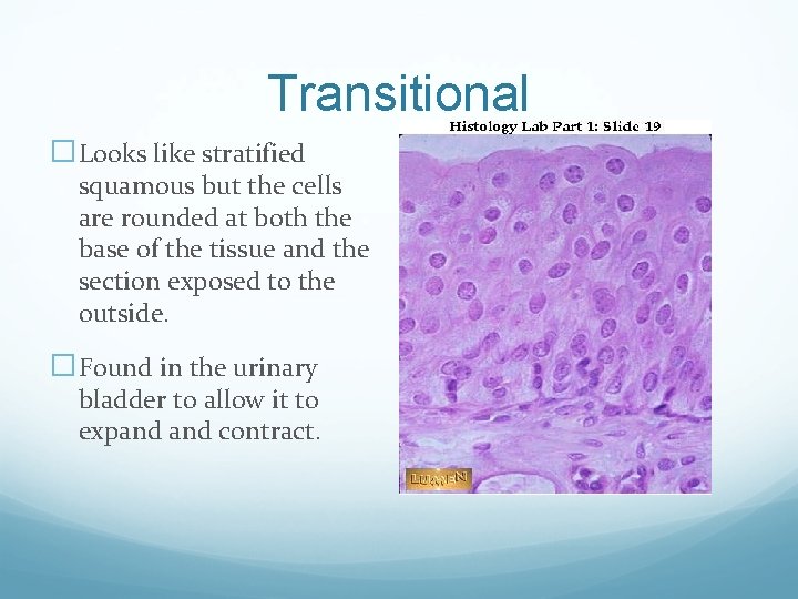 Transitional �Looks like stratified squamous but the cells are rounded at both the base