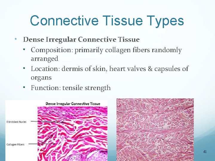 Connective Tissue Types • Dense Irregular Connective Tissue • Composition: primarily collagen fibers randomly
