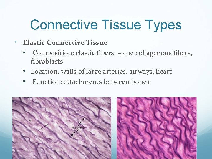 Connective Tissue Types • Elastic Connective Tissue • Composition: elastic fibers, some collagenous fibers,