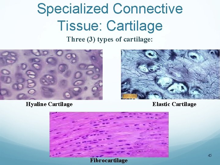 Specialized Connective Tissue: Cartilage Three (3) types of cartilage: Hyaline Cartilage Elastic Cartilage Fibrocartilage