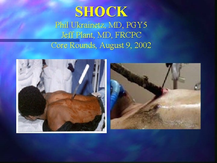 SHOCK Phil Ukrainetz, MD, PGY 5 Jeff Plant, MD, FRCPC Core Rounds, August 9, SHOCK Phil Ukrainetz, MD, PGY 5 Jeff Plant, MD, FRCPC Core Rounds, August 9,