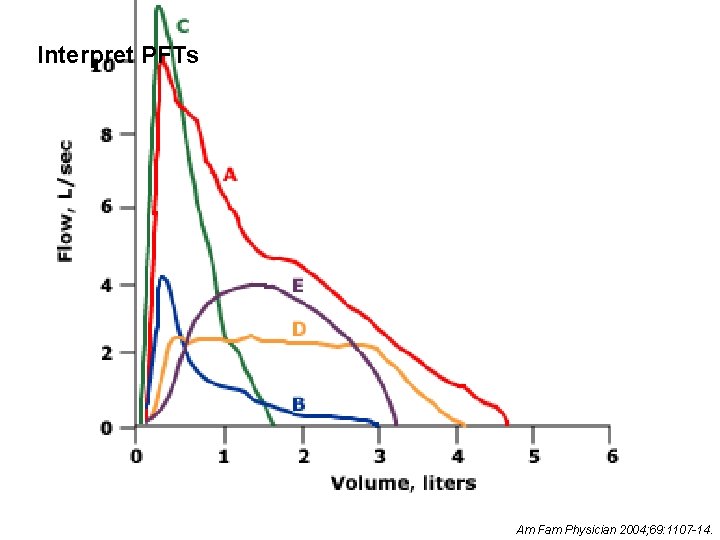 Interpret PFTs Am Fam Physician 2004; 69: 1107 -14. 