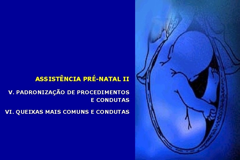 ASSISTÊNCIA PRÉ-NATAL II V. PADRONIZAÇÃO DE PROCEDIMENTOS E CONDUTAS VI. QUEIXAS MAIS COMUNS E