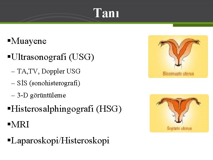 Tanı §Muayene §Ultrasonografi (USG) – TA, TV, Doppler USG – SİS (sonohisterografi) – 3