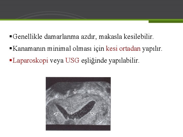 § Genellikle damarlanma azdır, makasla kesilebilir. § Kanamanın minimal olması için kesi ortadan yapılır.