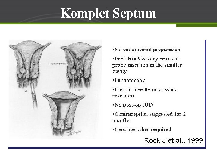 Komplet Septum 