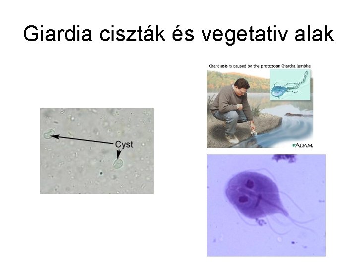 giardiasis ciszták)