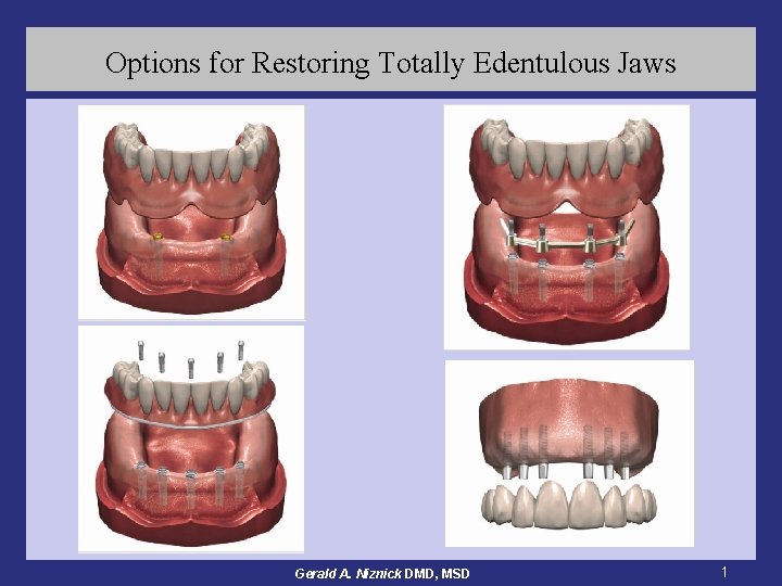 Options for Restoring Totally Edentulous Jaws Gerald A. Niznick DMD, MSD 1 