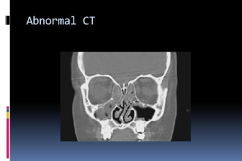 Abnormal CT 
