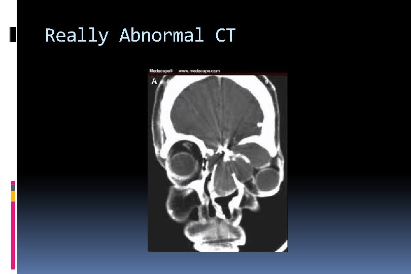 Really Abnormal CT 