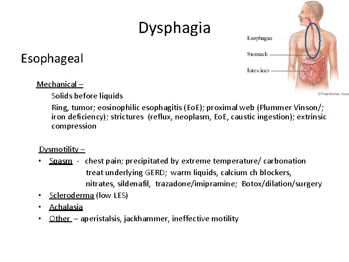 Dysphagia Esophageal Mechanical – Solids before liquids Ring, tumor; eosinophilic esophagitis (Eo. E); proximal