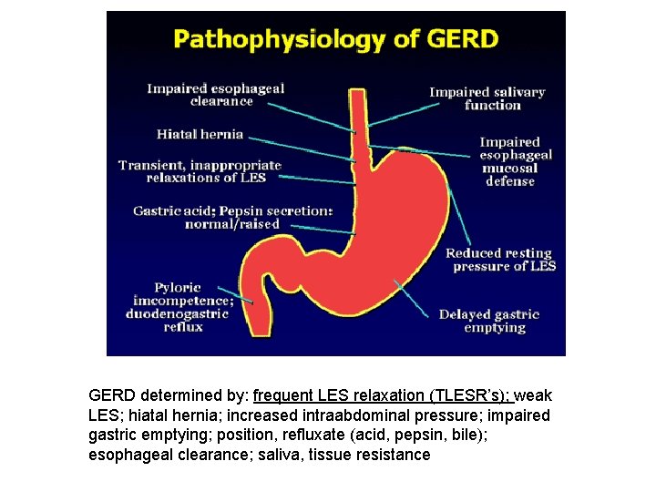 GERD determined by: frequent LES relaxation (TLESR’s); weak LES; hiatal hernia; increased intraabdominal pressure;