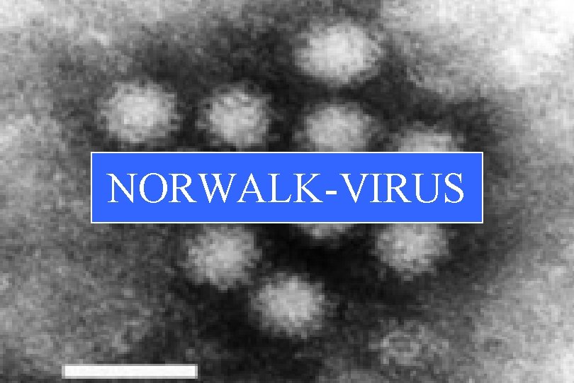 NORWALK-VIRUS 