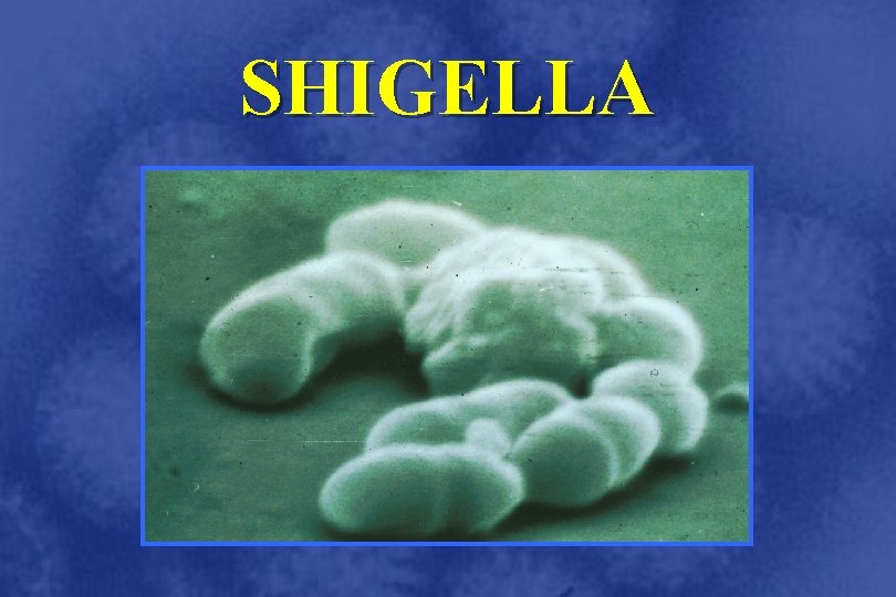 SHIGELLA 