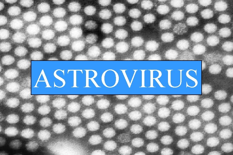 ASTROVIRUS 