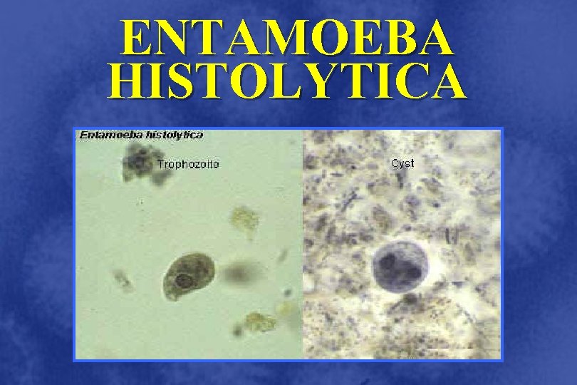 ENTAMOEBA HISTOLYTICA 