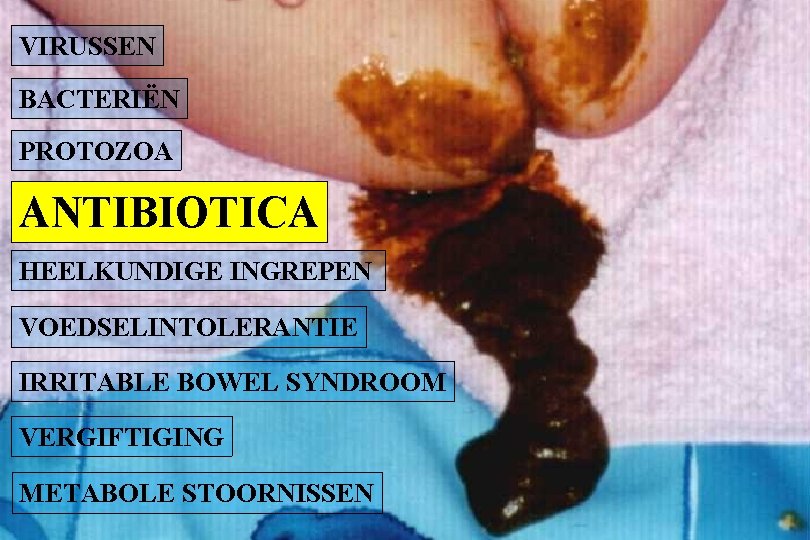 VIRUSSEN BACTERIËN PROTOZOA ANTIBIOTICA HEELKUNDIGE INGREPEN VOEDSELINTOLERANTIE IRRITABLE BOWEL SYNDROOM VERGIFTIGING METABOLE STOORNISSEN 