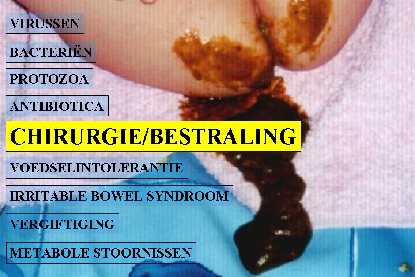 VIRUSSEN BACTERIËN PROTOZOA ANTIBIOTICA CHIRURGIE/BESTRALING VOEDSELINTOLERANTIE IRRITABLE BOWEL SYNDROOM VERGIFTIGING METABOLE STOORNISSEN 