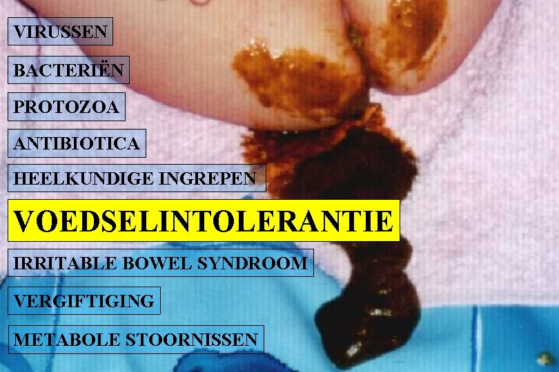 VIRUSSEN BACTERIËN PROTOZOA ANTIBIOTICA HEELKUNDIGE INGREPEN VOEDSELINTOLERANTIE IRRITABLE BOWEL SYNDROOM VERGIFTIGING METABOLE STOORNISSEN 