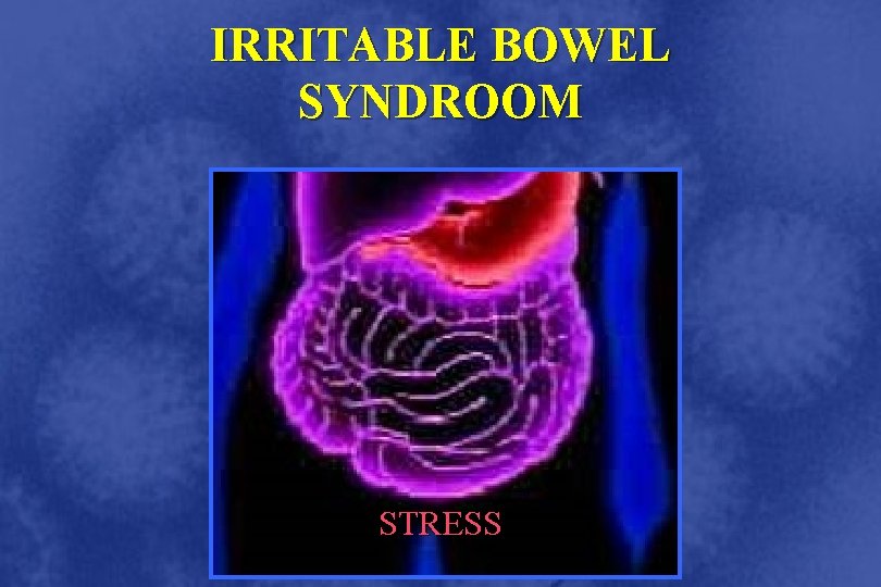 IRRITABLE BOWEL SYNDROOM STRESS 