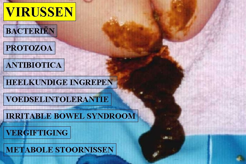 VIRUSSEN BACTERIËN PROTOZOA ANTIBIOTICA HEELKUNDIGE INGREPEN VOEDSELINTOLERANTIE IRRITABLE BOWEL SYNDROOM VERGIFTIGING METABOLE STOORNISSEN 