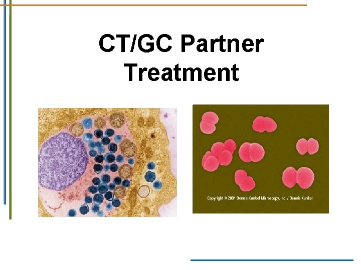 CT/GC Partner Treatment CT/GC Partner Treatment