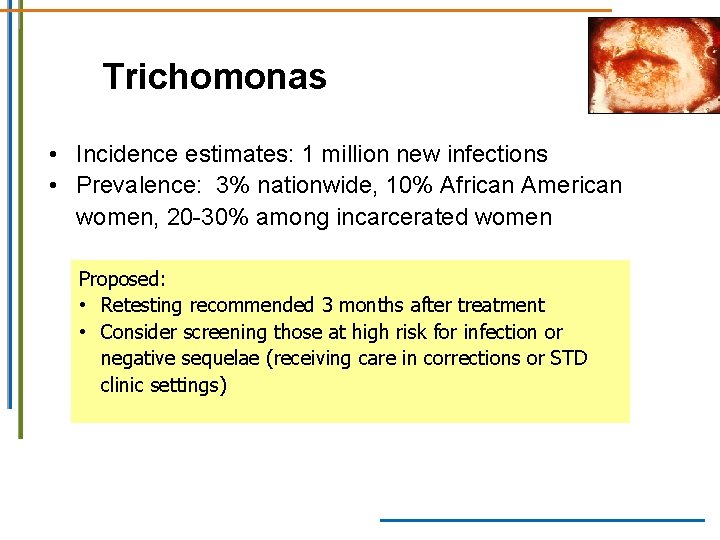 Trichomonas • Incidence estimates: 1 million new infections • Prevalence: 3% nationwide, 10% African Trichomonas • Incidence estimates: 1 million new infections • Prevalence: 3% nationwide, 10% African
