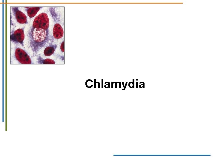 Chlamydia Chlamydia