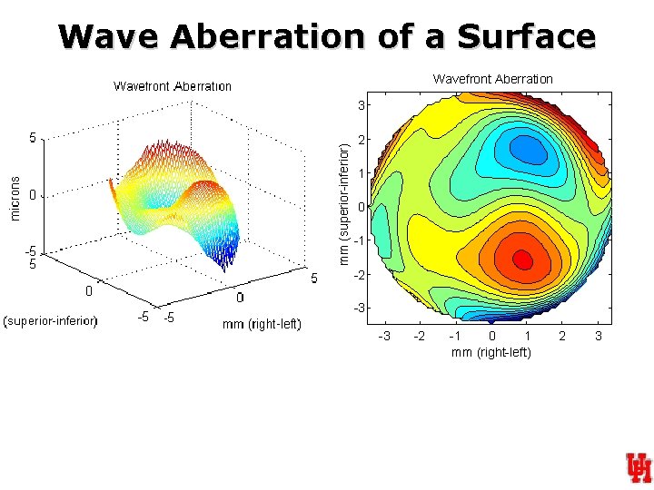 Wave Aberration of a Surface Wavefront Aberration mm (superior-inferior) 3 2 1 0 -1