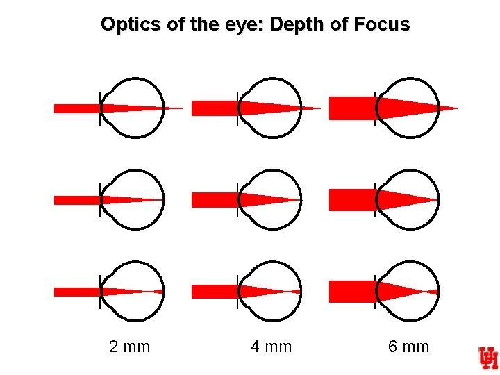 Optics of the eye: Depth of Focus 2 mm 4 mm 6 mm 