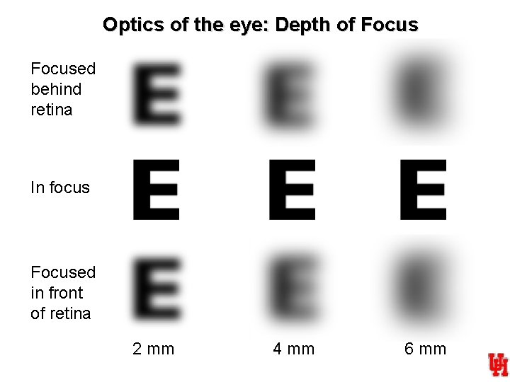 Optics of the eye: Depth of Focused behind retina In focus Focused in front