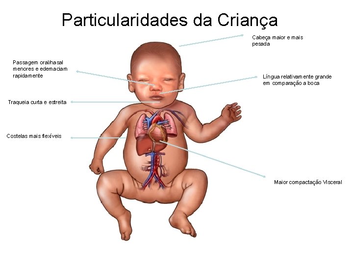 Particularidades da Criança Cabeça maior e mais pesada Passagem oral/nasal menores e edemaciam rapidamente