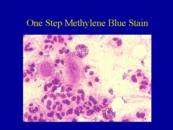 One Step Methylene Blue Stain 