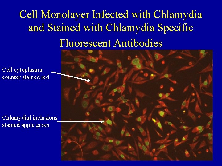 Cell Monolayer Infected with Chlamydia and Stained with Chlamydia Specific Fluorescent Antibodies Cell cytoplasma