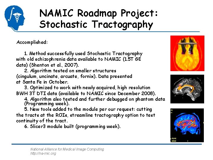 NAMIC Roadmap Project: Stochastic Tractography Accomplished: 1. Method successfully used Stochastic Tractography with old